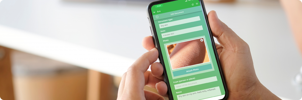 A person recording their health indicator - dry skin- in the Personal Health Record (PHR) section of their Evergreen Life app.