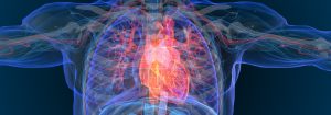 What is a heart attack computer generated render of a human torso with heart visible